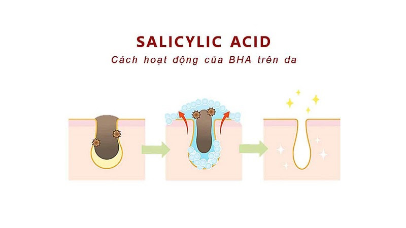 Salicylic acid giúp làm sạch sâu từ lỗ chân lông
